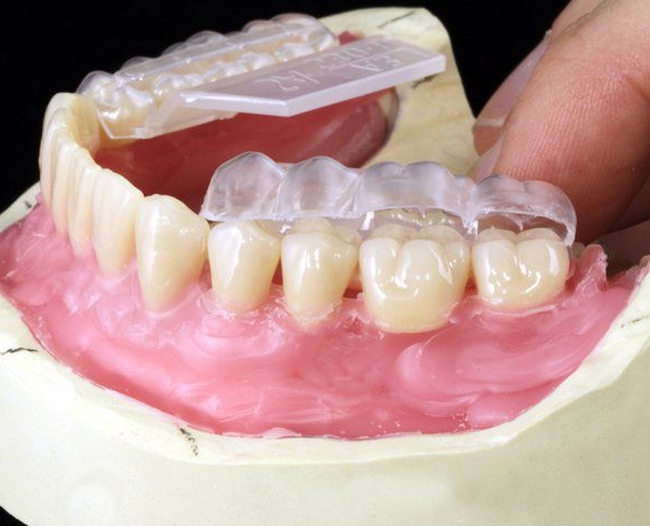 Какие съемные зубные протезы лучше выбрать?