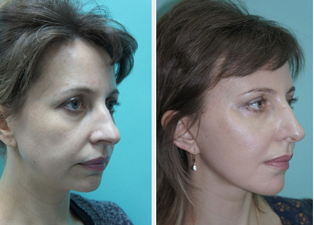 29482-3 Топ-5 советов как сделать лицо красивым от Андрея Искорнева