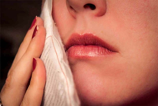 Идет кровь после удаления зуба – как ее остановить?