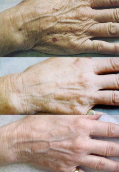 Возможности Элос технологии