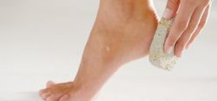 Лечение шпор народными методами и средствами