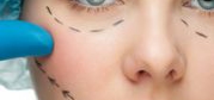 Что такое эндоскопический лифтинг лица?