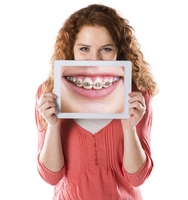 художественная реставрация передних зубов