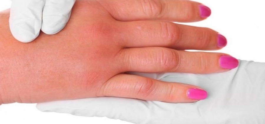 Какие продукты помогают вывести воду из организма?