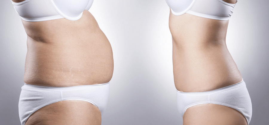 Как убрать живот после 50 лет — 5 лучших способов