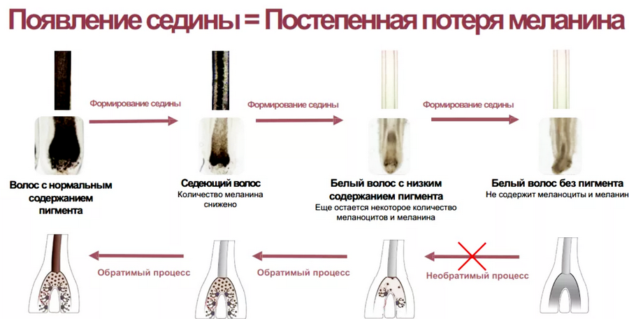 uxod-za-sedymi-volosami-bez-okrashivaniya (2) 7 особенностей ухода за седыми волосами без окрашивания