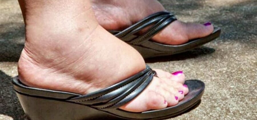 4 лучших народных средства, чтобы избавиться от отеков ног