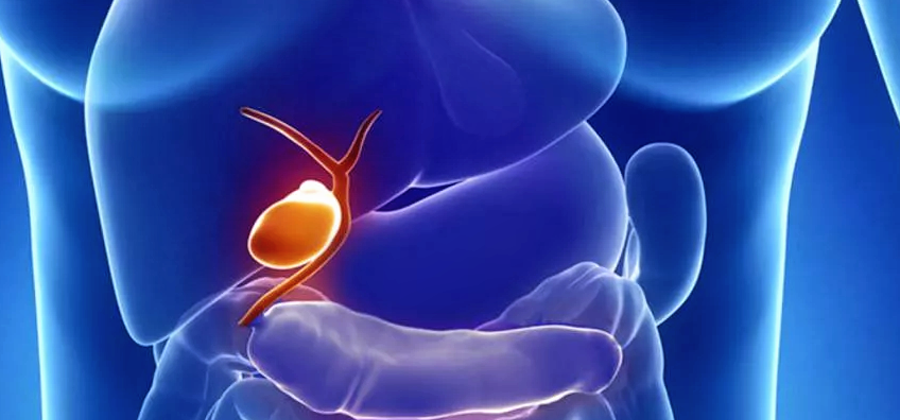 17 желчегонных продуктов, которые должен есть каждый