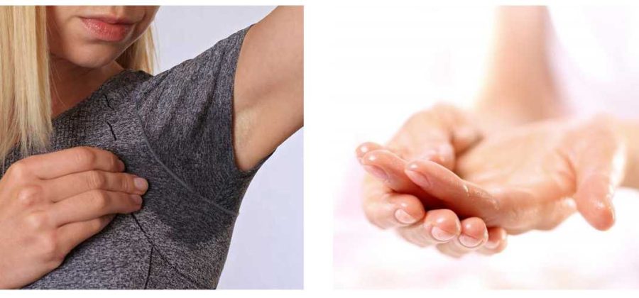 Когда нужно использовать ботокс от гипергидроза: подробное руководство