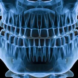 Когда нужен рентген челюсти