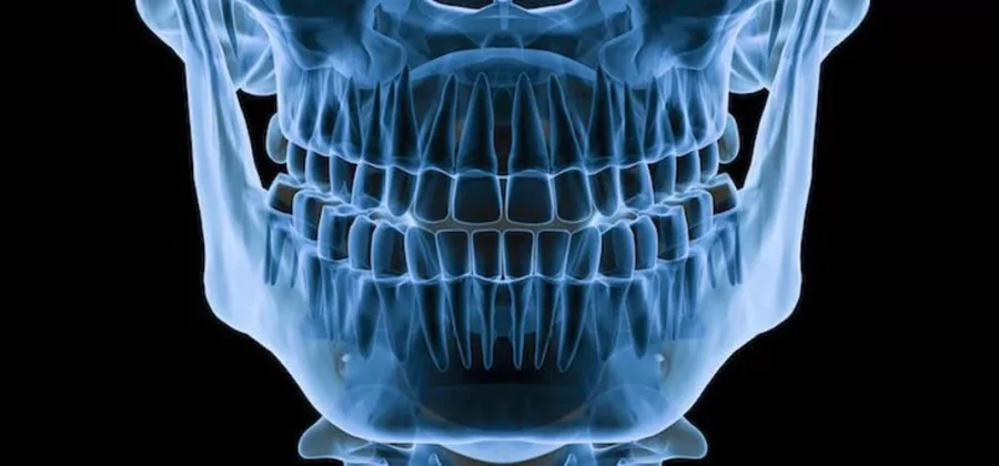 Когда нужен рентген челюсти