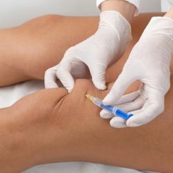 Миф о дряблой коже после липолиза: можно ли сохранить эластичность при уменьшении объемов с Contourslim?