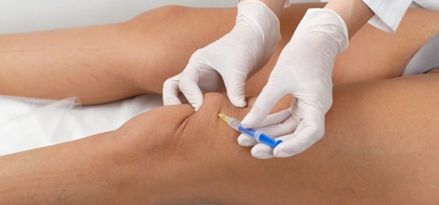 Миф о дряблой коже после липолиза: можно ли сохранить эластичность при уменьшении объемов с Contourslim?