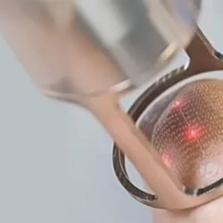 Лазерная шлифовка лица: что это такое и кому она подходит?