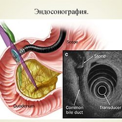 Выбор метода: эндоскопическое УЗИ, КТ или МРТ?