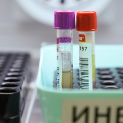 Назван анализ крови, который нужно сдать после новогодних праздников