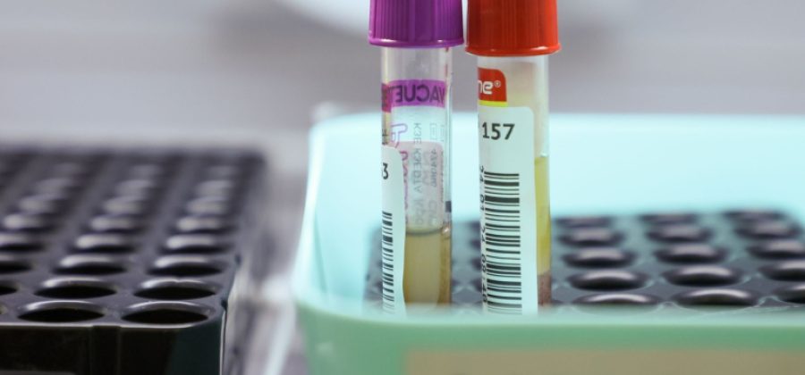 Назван анализ крови, который нужно сдать после новогодних праздников