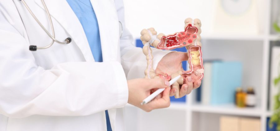 Врач развеял популярный миф о печени и кишечнике