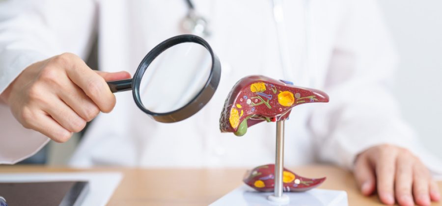 Можно ли вылечить, только ли из-за водки: врач рассказала все про цирроз