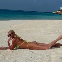 Профдеформация. Врач Звонков оценил состояние ног Волочковой