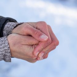 Травматолог назвал главную ошибку при обморожении