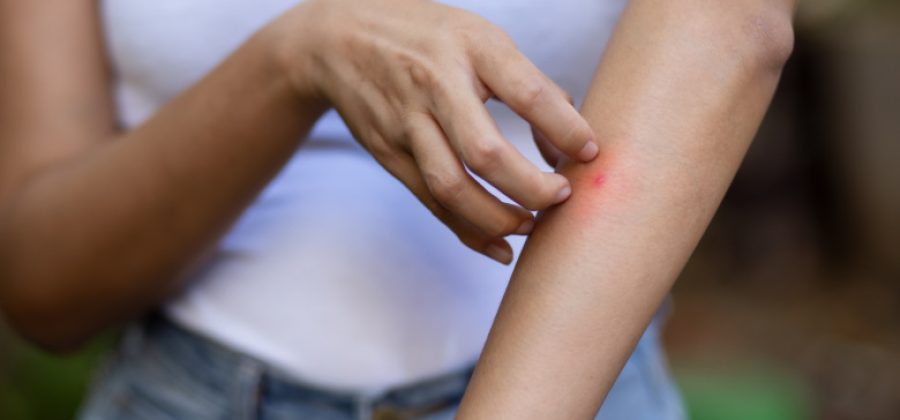 Врач назвал самый распространенный вид аллергии