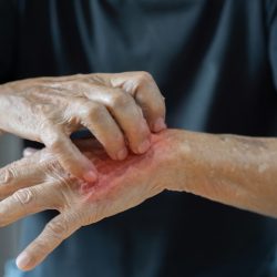 Врач предупредила об опасных инфекциях при примерке одежды