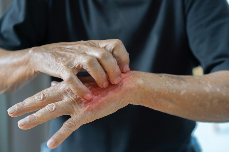 Врач предупредила об опасных инфекциях при примерке одежды