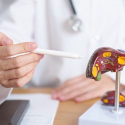 Врач развеяла главный миф о причинах цирроза печени