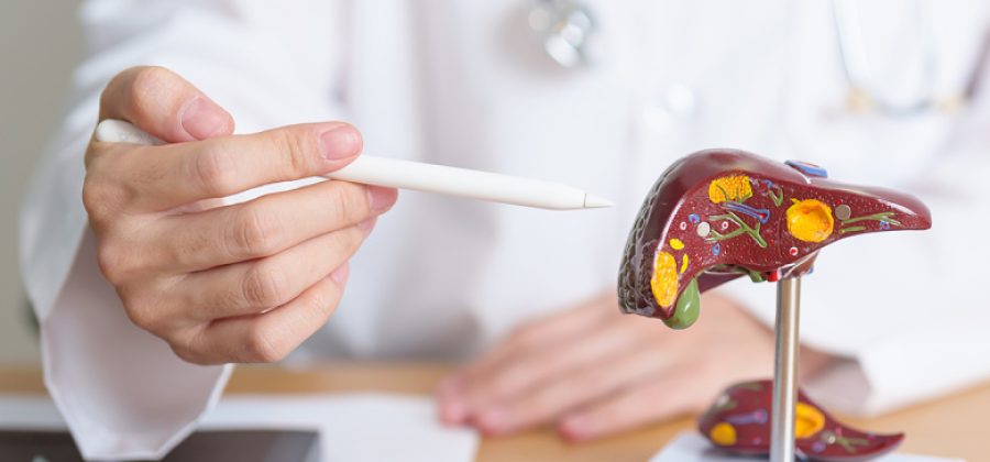 Врач развеяла главный миф о причинах цирроза печени