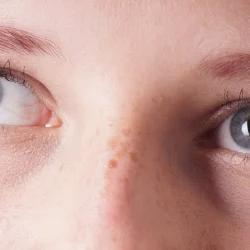 Мушки в глазах. Причины и лечение.