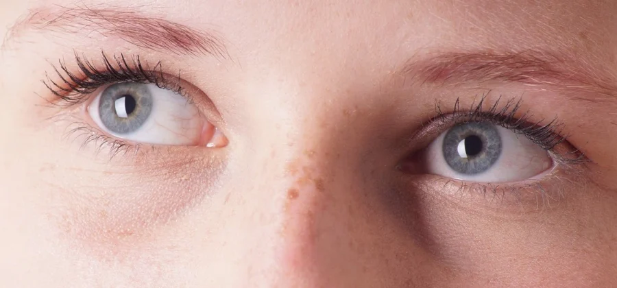 Мушки в глазах. Причины и лечение.