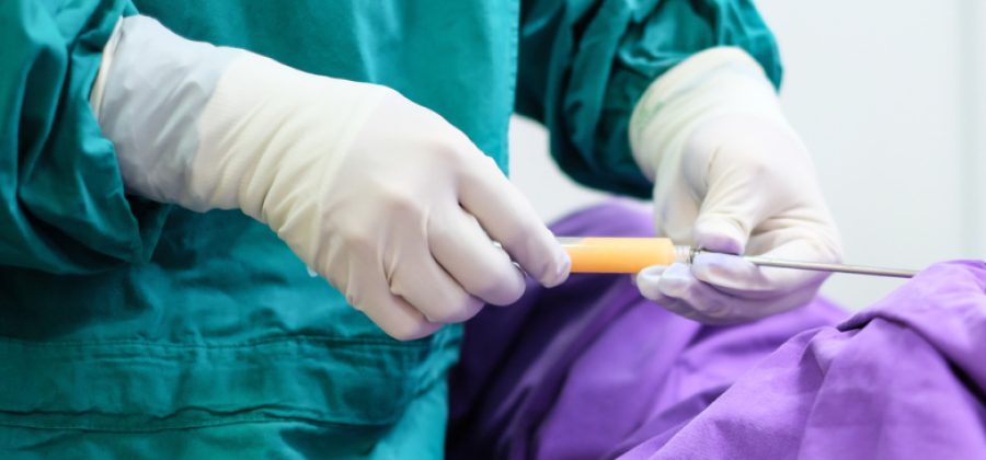 Хирург раскрыла, можно ли делать липосакцию сразу нескольких зон