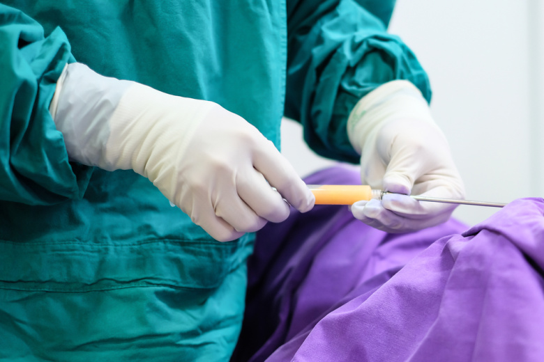 Хирург раскрыла, можно ли делать липосакцию сразу нескольких зон