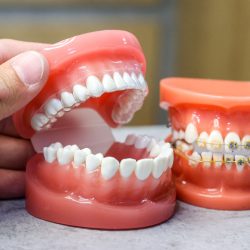 Ортодонт назвала тревожные причины щелчков в челюсти