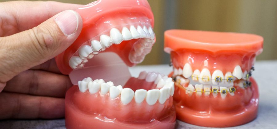 Ортодонт назвала тревожные причины щелчков в челюсти