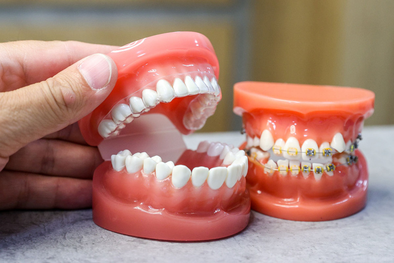 Ортодонт назвала тревожные причины щелчков в челюсти