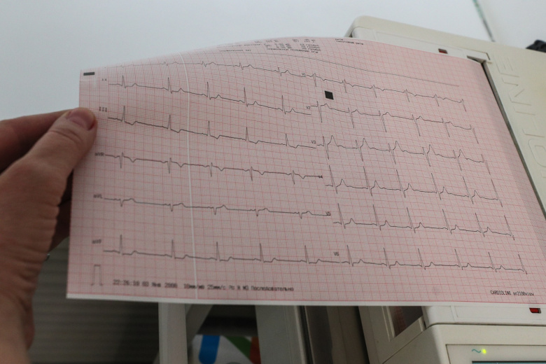 Врач предупредил, какие опасные состояния маскируются под панические атаки
