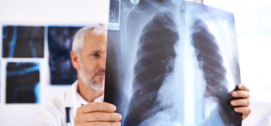 Врач рассказал, кто прежде всего рискует заболеть туберкулезом
