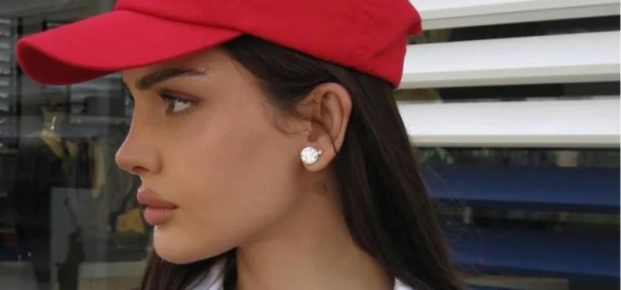 Дина Саева показала лицо после повторной пластики — фото до и после