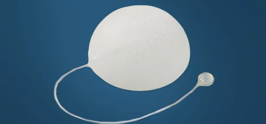 Экспандеры молочной железы: современный путь к восстановлению и уверенности