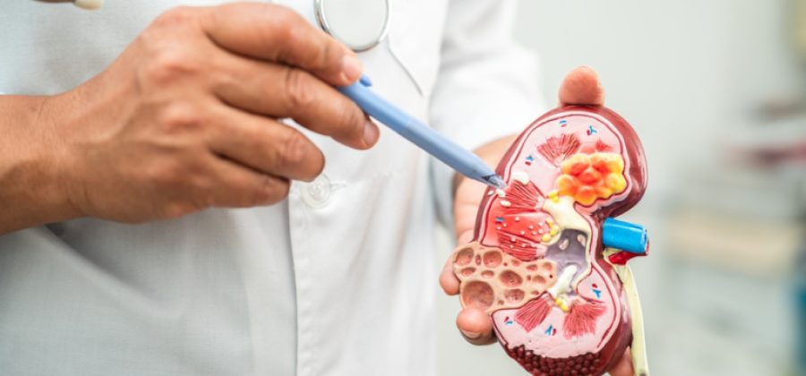Предотвращаем камни в почках и жизнь на диализе: пять ценных советов врача