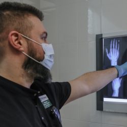 Травматолог рассказал, как отличить ушиб от перелома