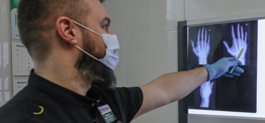 Травматолог рассказал, как отличить ушиб от перелома