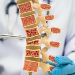 Врач предупредил о неочевидной привычке, незаметно портящей осанку