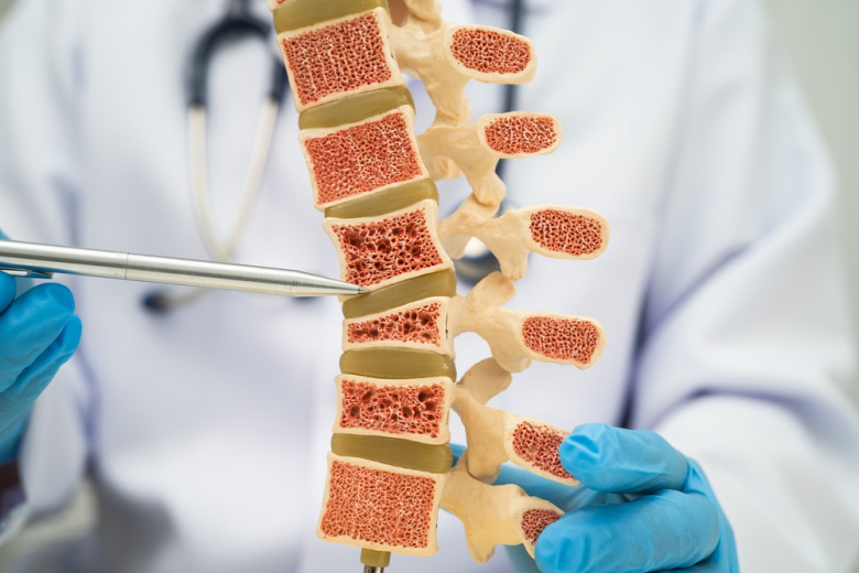 Врач предупредил о неочевидной привычке, незаметно портящей осанку