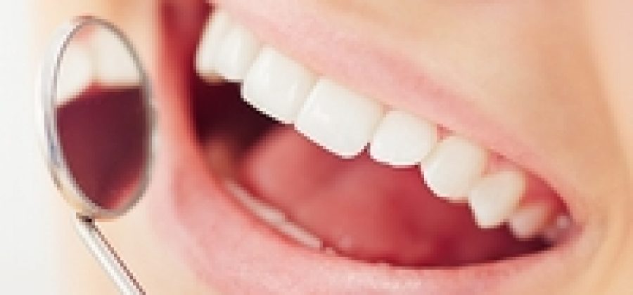 Как стоматологи лечат кариес методом Icon?