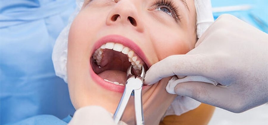 Идет кровь после удаления зуба – как ее остановить?